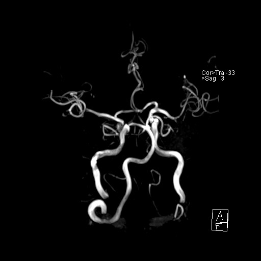 Click on the Serie image to view the images of VILLANUEVA, WILLIAM A.